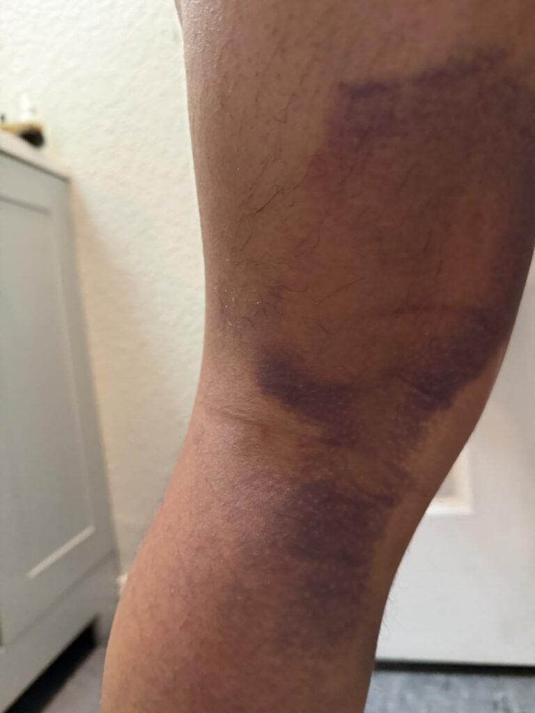 Image #1 from Anthony Pollard