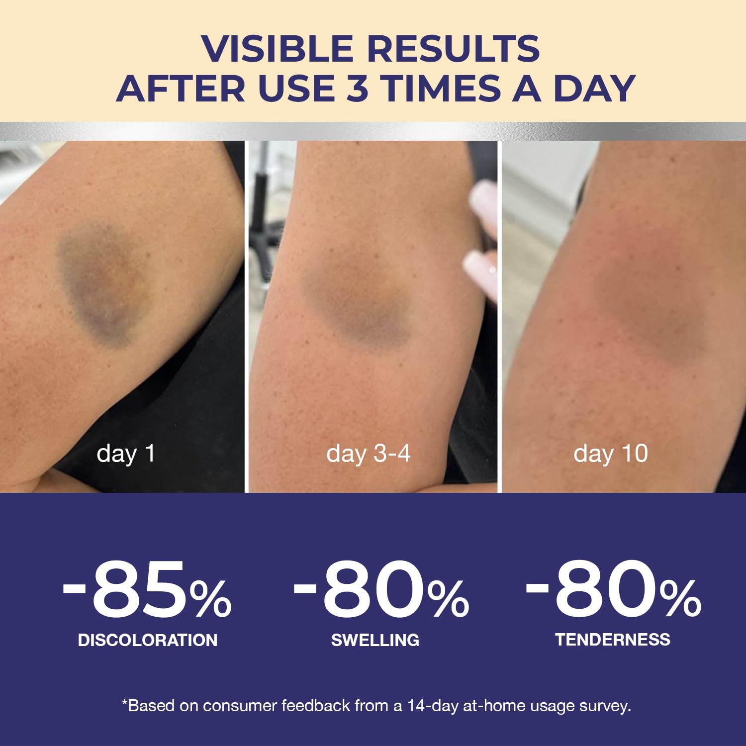 Arnica Bruise Cream Extra Strength - Image 6